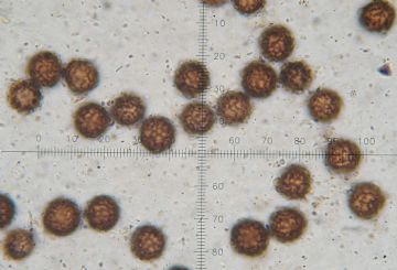 Scleroderma citrinum-esporas ( Autor : Augusto Calzada )