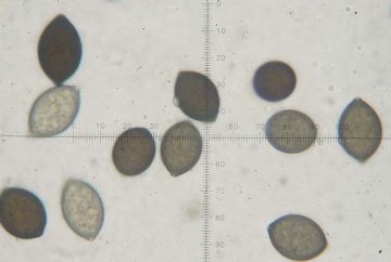 Melanospora zobelii ( Microthecium zobelii )